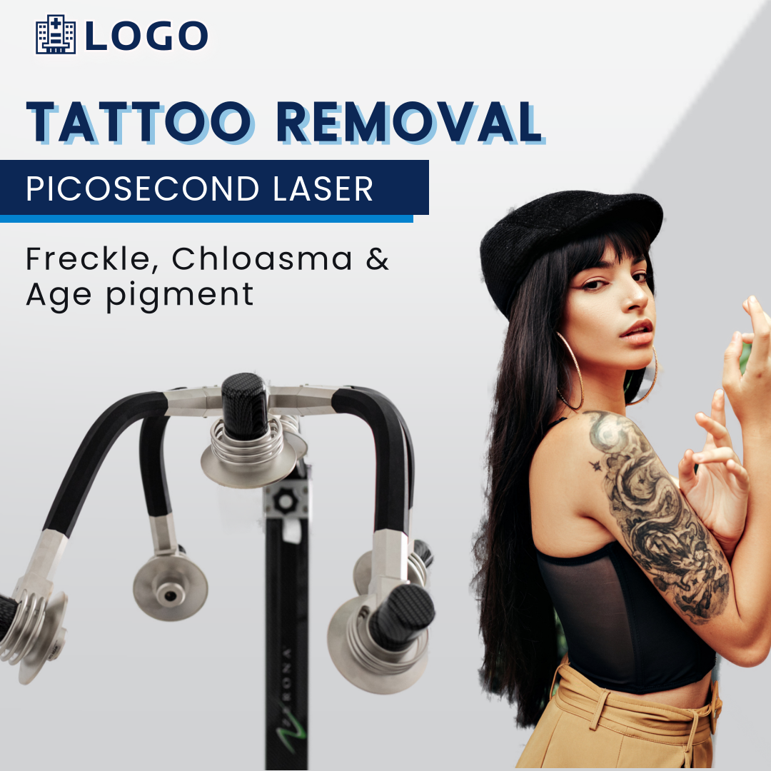 Geo Laser Tattoo Removal Treatment at Rs 1000/inch in Chennai | ID:  9317230973